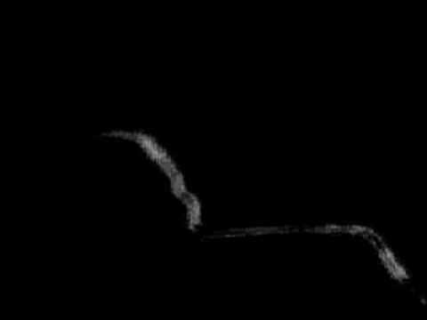 youtube placeholder image